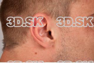 Ear texture of Gene 0001